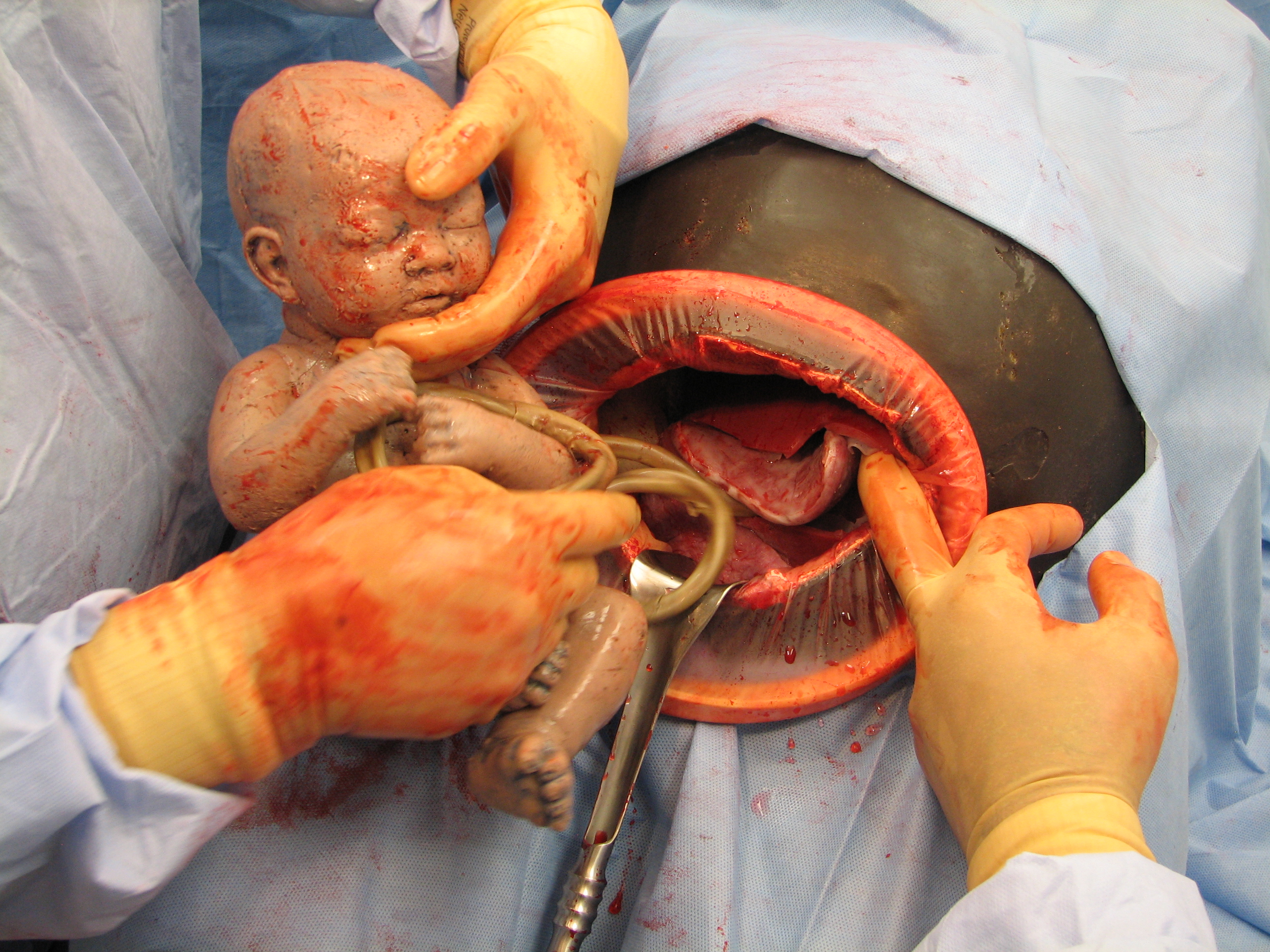 Fetal Extraction Trainer