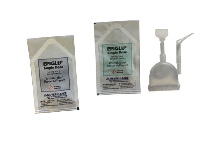 EPIGLU®  - the universal tissue adhesive