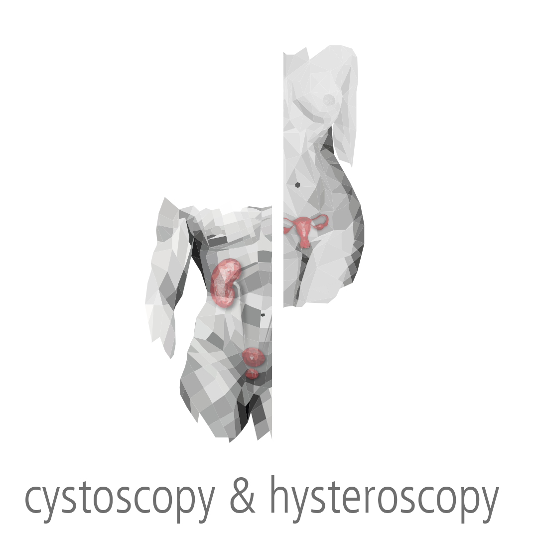 cystoscopy & hysteroscopy