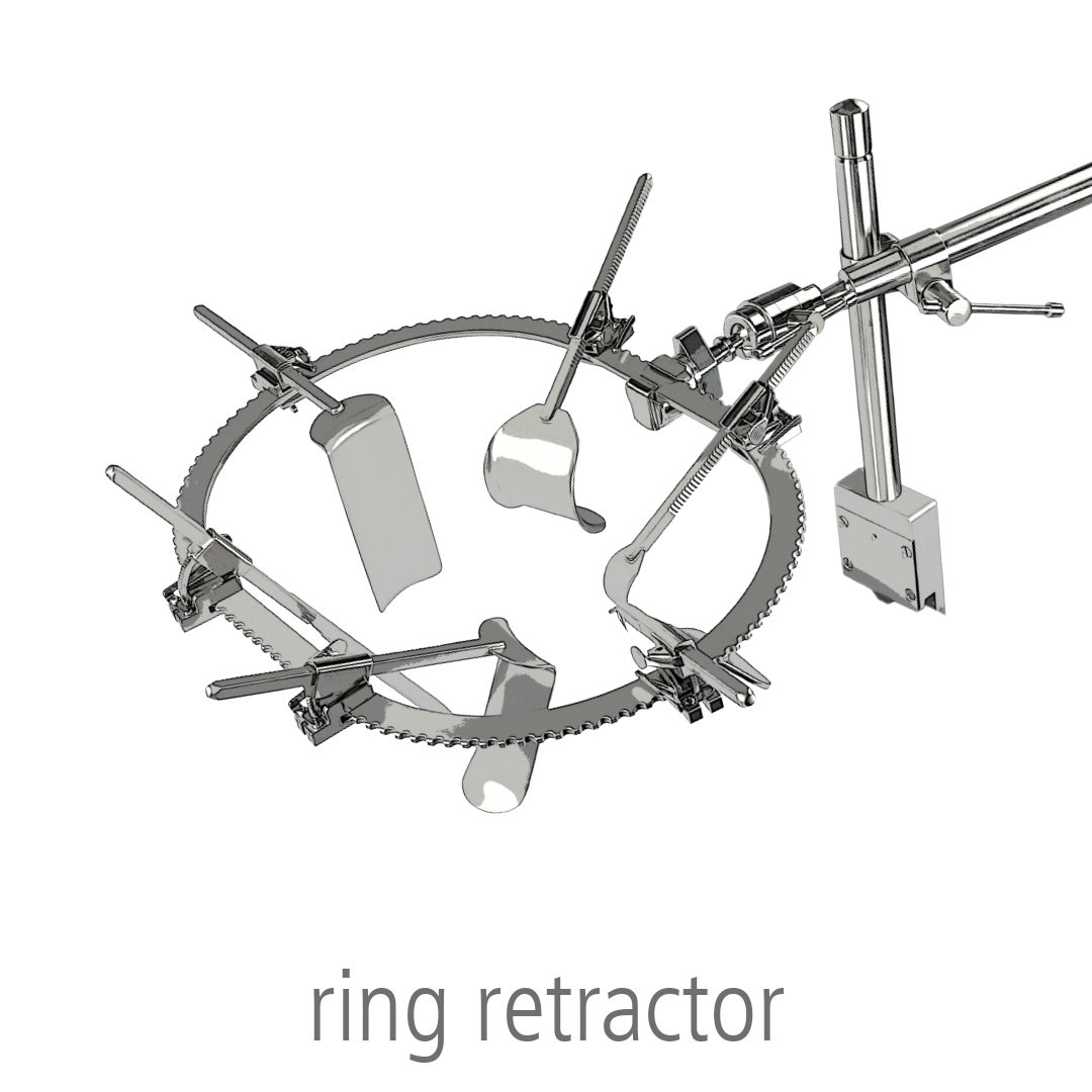 nopa ring retractor